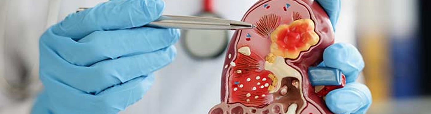 Nephrology